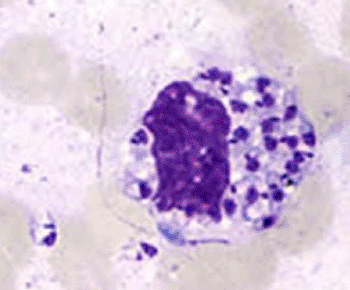 Imagen: Amastigotes de Leishmania en una lámina coloreada (Fotografía cortesía de los Centros para el Control de Enfermedades de los Estados Unidos)